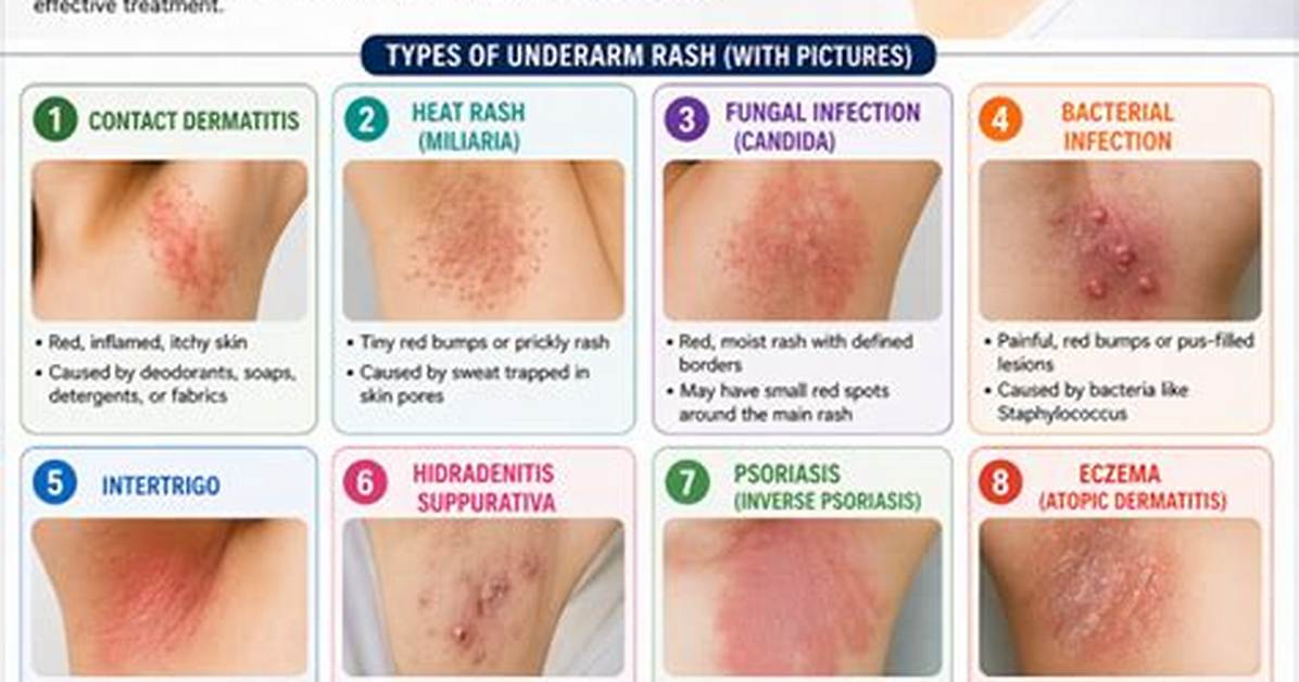 6 Causes of Underarm Rashes and How to Avoid Irritating Your Armpits