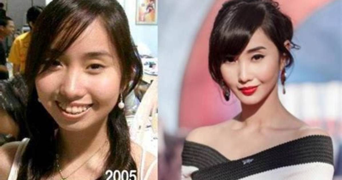 Alodia Gosiengfiao Before Operation and Surgery Photos on Instagram, Fhm Cover Girl Looked Different ·
