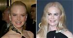 Behind the Lens: Nicole Kidman Botox Photos and the Pursuit of Timeless Beauty