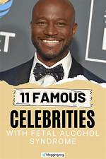 Celebrities Plagued by Fetal Alcohol Syndrome