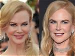 Did Nicole Kidman Get a Rhinoplasty? Explore the Transformation Rumors