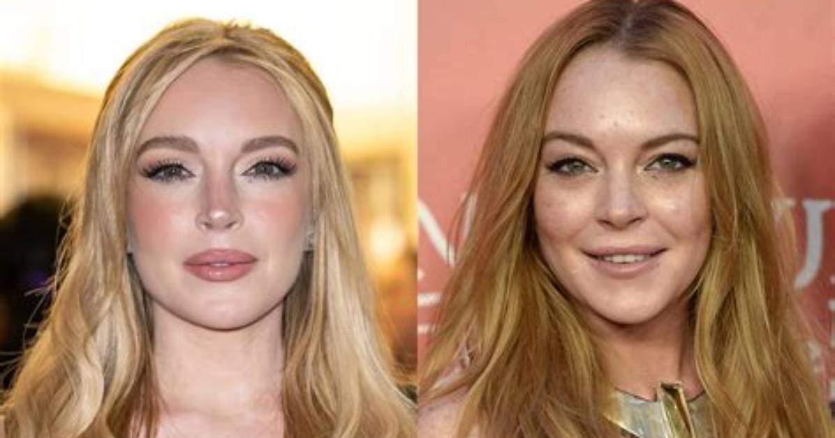 Did Xooos Get Plastic Surgery? Check Her Before and After Picture ·