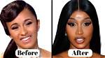 Did Yodit Yemane Have Plastic Surgery? See Her Before and After Pictures