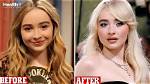 Discover Sabrina Carpenter's Journey with Plastic Surgery