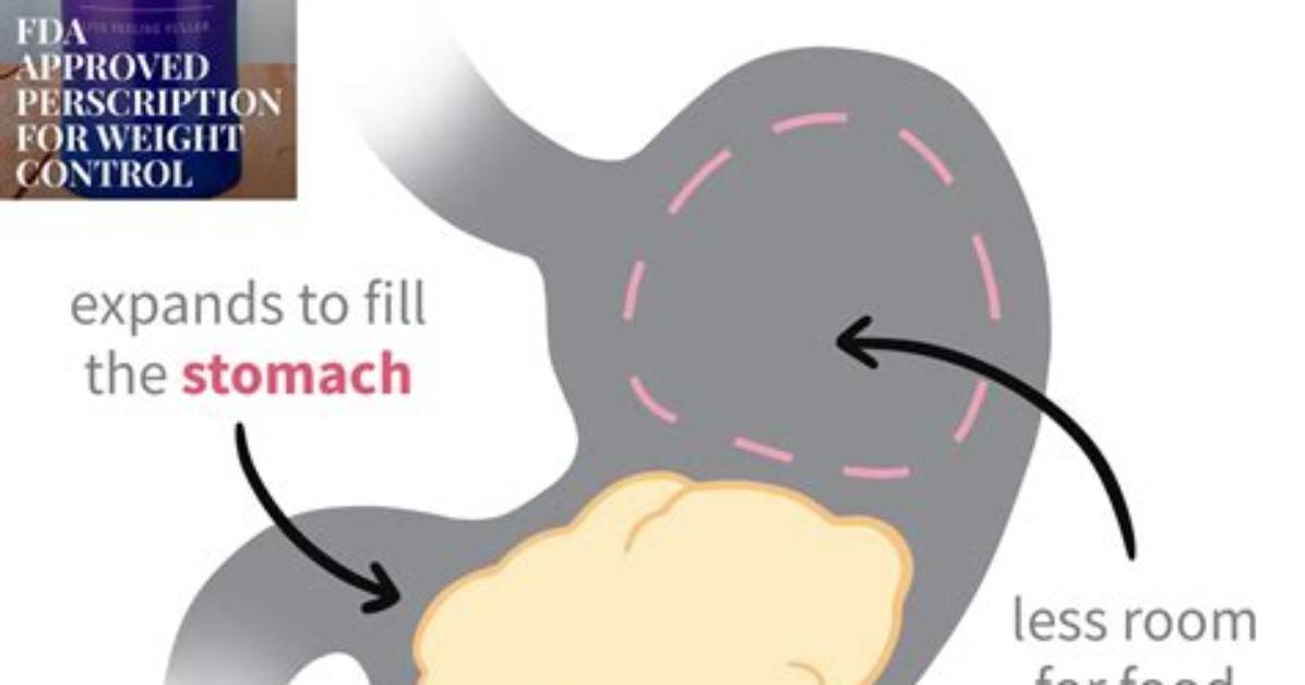 Discovering Plenity Weight Loss: a Revolutionary Approach to Shedding Pounds