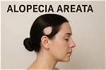 Does Rylee Langerman Have an Alopecia or Cancer? Details to Know |