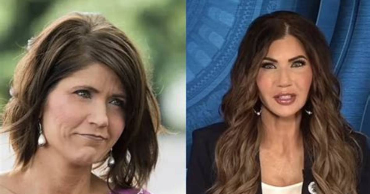 Exploring Kristi Noem: Plastic Surgery Before and After