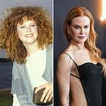 Exploring the Complexion of Nicole Kidman: Does She Have Freckles?