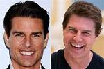 Exploring Tom Cruise's Hollywood Smile
