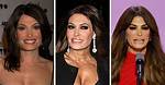 Guilfoyle's Transformation: a Visual Journey from Before to After