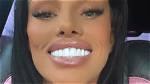 Has Nany Had Her Teeth Done? Truth Behind Appearance Revealed Thu 25 March 2021 ·