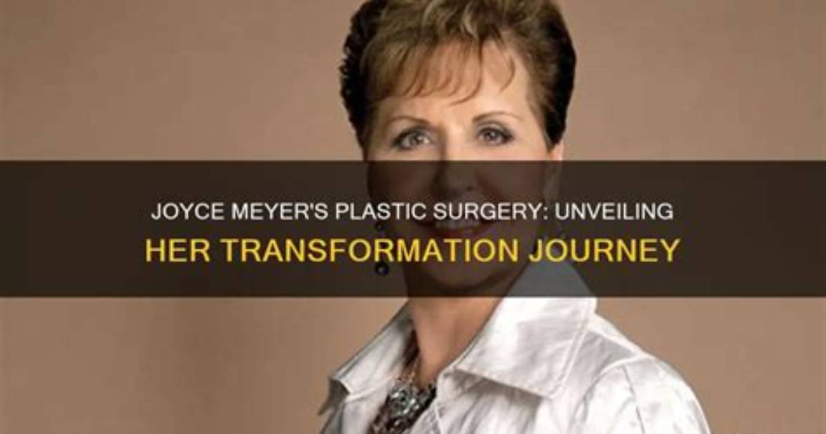 Joyce Meyer's Plastic Surgery Journey: Unveiling the Truth