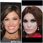 Kimberly Guilfoyle's Plastic Surgery Journey: Before and After