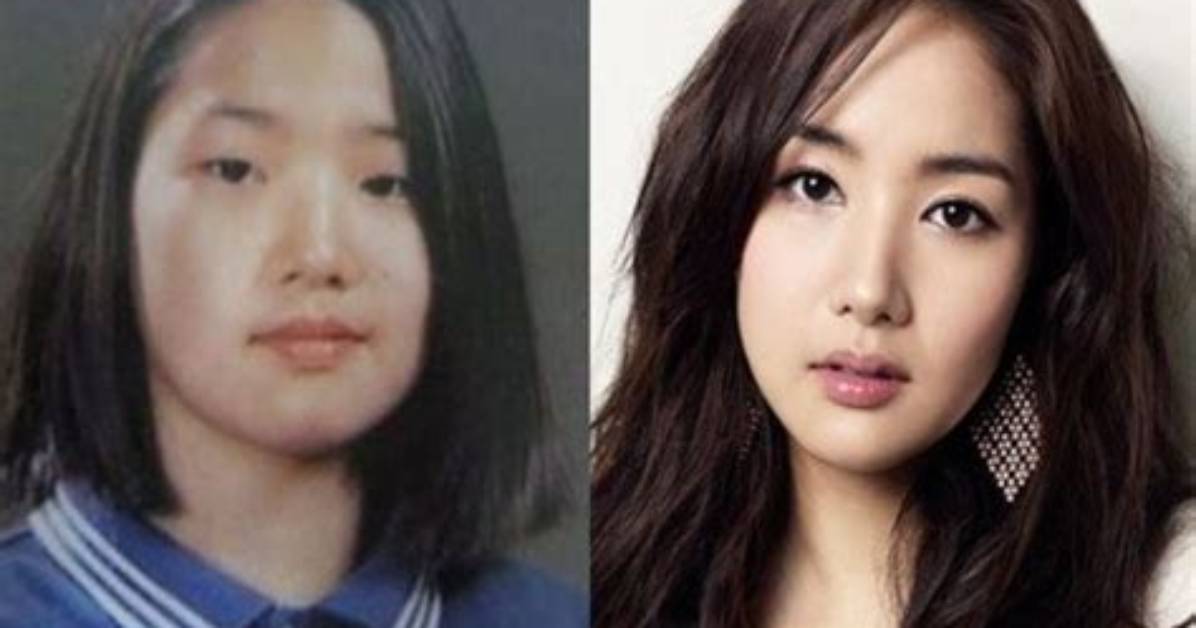 Korean Actors Surgery Before and After: the Transformative Journey