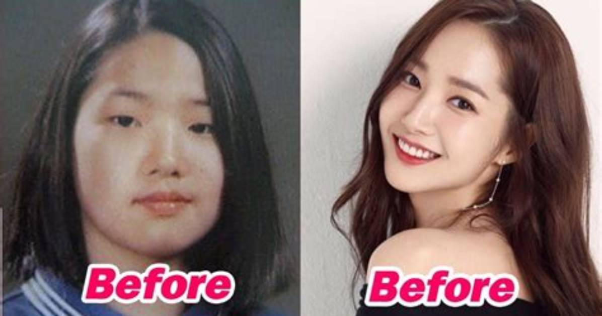 Korean Plastic Surgery Celebrity: the Transformative Journey of Beauty