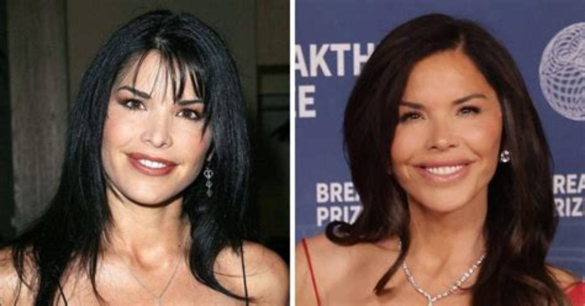 Lauren Sanchez Before and After Photos: Did Jeff Bezos’ Fiancee Undergo Plastic Surgery?