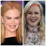 Nicole Kidman's Plastic Surgery Journey: a Transformation Through Time