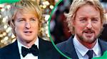 Owen Wilson's Nose and the Truth Behind Its Shape
