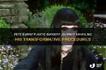 Pete Burns Is He Transgender? Transformative Procedures and Gender and Sexuality