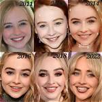 Proof of Sabrina Carpenter's Lip Injections: the Unseen Truth