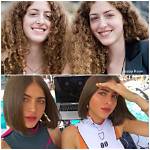 Simi and Haze Khadra Before and After: Fai Khadra Sisters Before Surgery