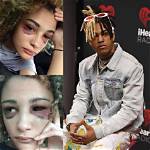 So, What Actually Happened with Geneva Ayala Pregnancy and Xxxtentacion Child Amidst Abuse Claims