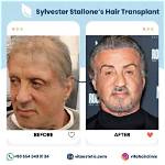 Sylvester Stallone: the Iconic Journey of a Hollywood Legend