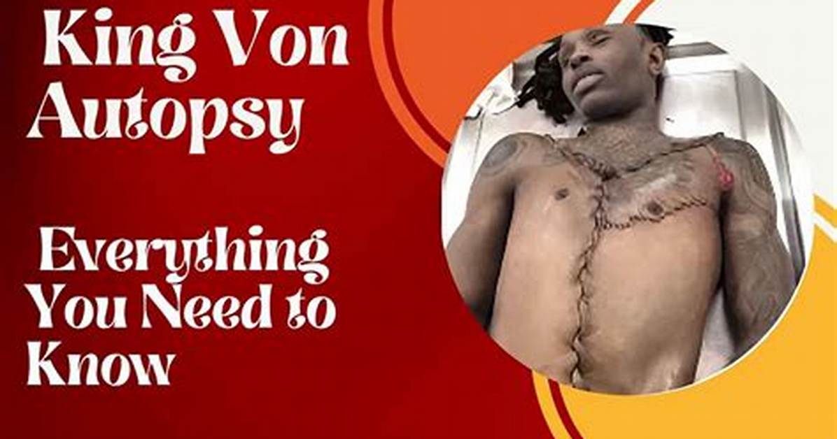 The Definitive Guide to King Von Autopsies: Exploring the Facts