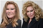 The Enigmatic Transformation of Jocelyn Wildenstein: a Journey of Excess and Controversy