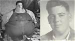 The Fattest Person in the World
