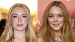 The Plastic Surgery Journey of Lindsay Lohan