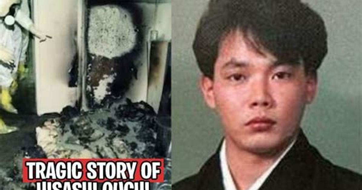 The Tragic Story of Hisashi Ouchi: a Case of Nuclear Accident and Human Resilience