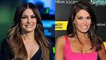 Transformation Journey: Kimberly Guilfoyle Before and After Botox