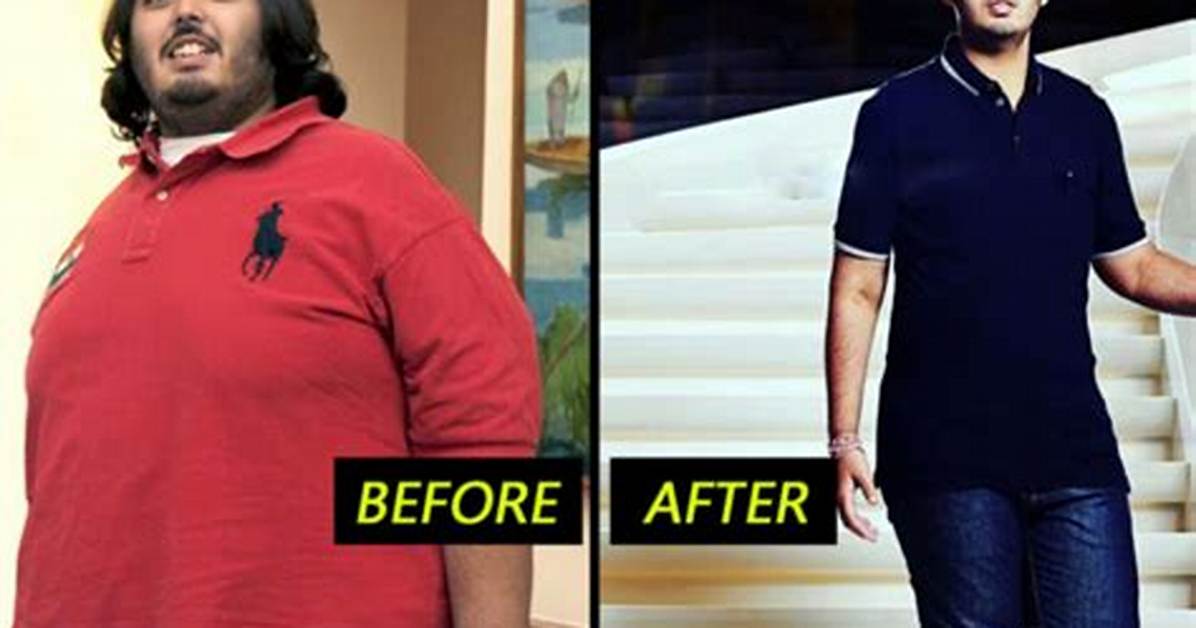 Transformative Journey: Anant Ambani's Weight Loss Surgery