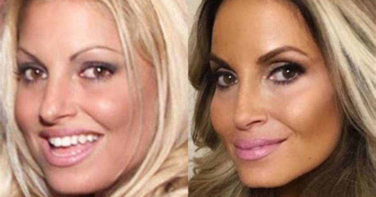 Trish Stratus Plastic Surgery: Before and After Photos