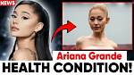 Uncovering the Truth: Ariana Grande's Health Battle with Cancer?