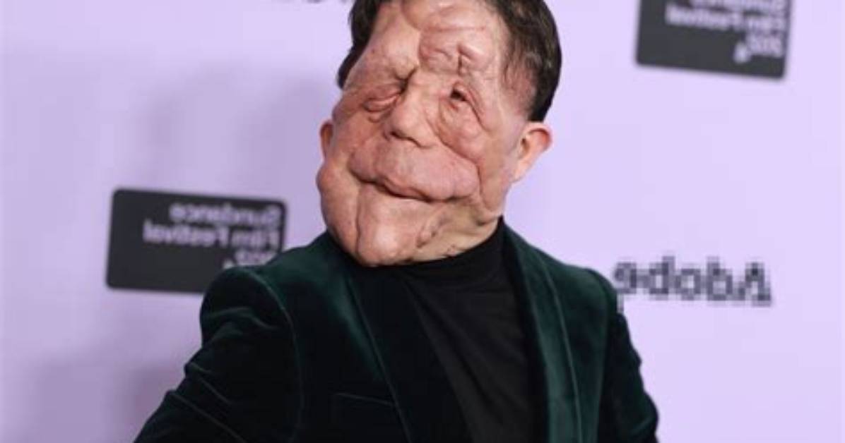 Understanding Adam Pearson's Girlfriend: a Deep Dive into His Personal Life
