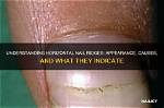 Understanding Horizontal Lines on Fingernails: What They Mean and Why They Occur