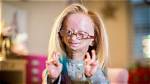 Unraveling the Age of Adalia Rose: a Journey Through Life