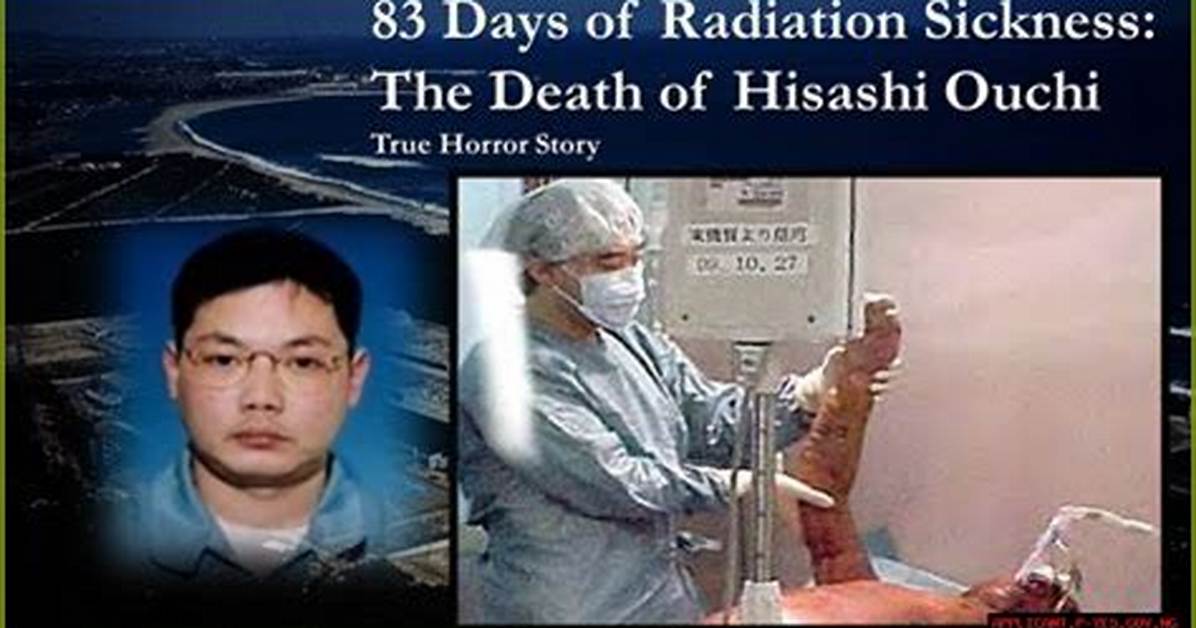 Unraveling the Tragic Tale of Hisashi Ouchi: the Man Whose Skin Fell Off