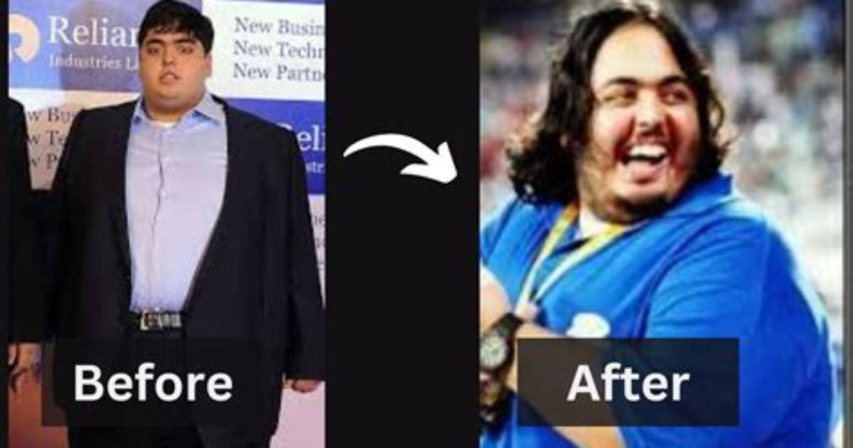 Unveiling Anant Ambani's Stomach: a Journey of Health and Transformation