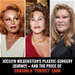 Unveiling Jocelyn Wildenstein: Beyond the Headlines