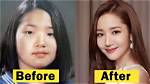 Unveiling Park Min Young's Transformation: Surprising Insights Pre-Plastic Surgery