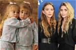 Unveiling the Mystery of Mary Kate Olsen's Buccal Fat