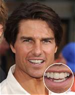 Unveiling the Mystery of Middle Tooth Tom Cruise