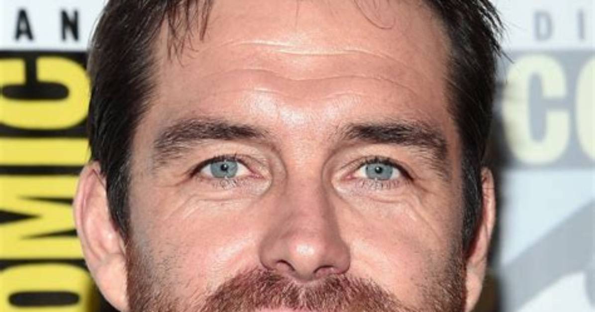 Unveiling the Truth Behind Antony Starr Hair Loss
