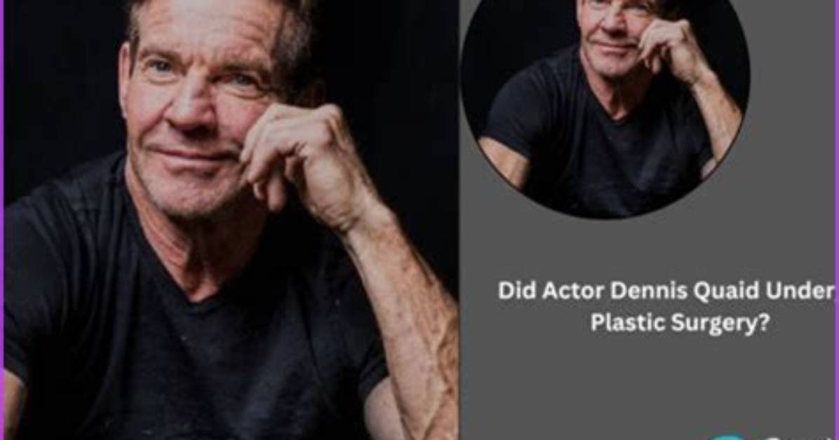 Unveiling the Truth Behind Dennis Quaid's Plastic Surgery Journey