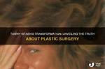 Unveiling the Truth Behind Tawny Kitaen's Botched Surgeries