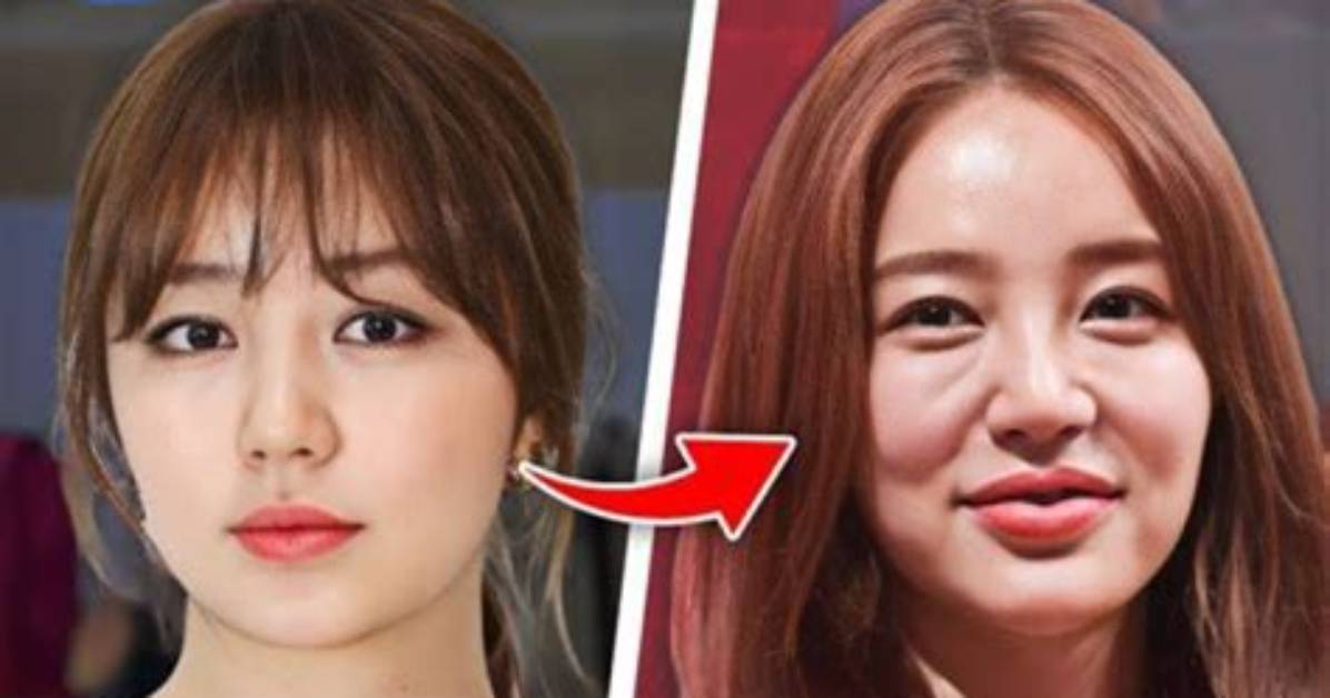 Unveiling the Truth: Do Most Korean Actors Have Plastic Surgery?