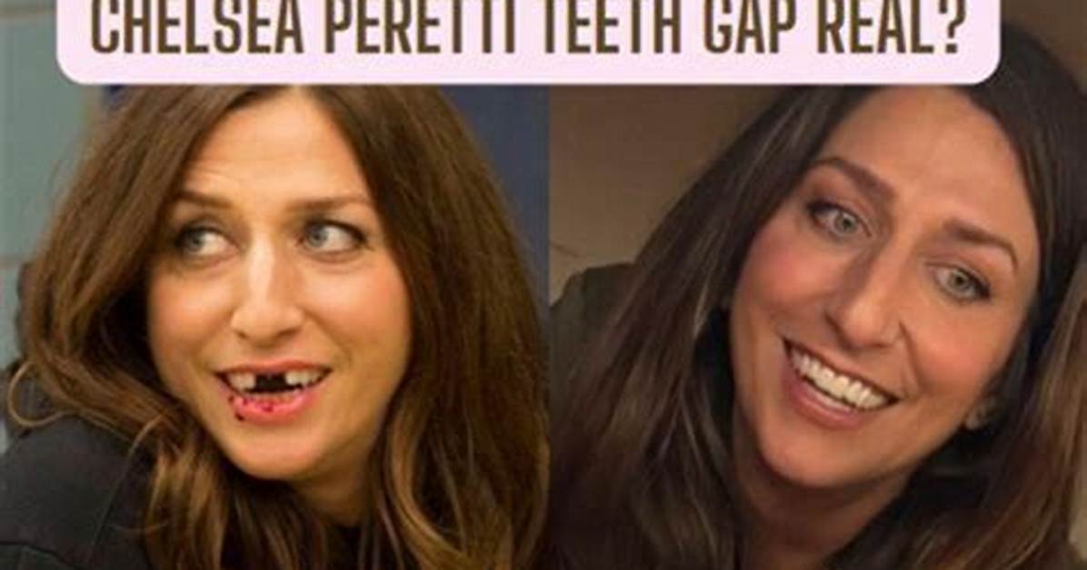 Unveiling the Truth: Does Chelsea Peretti Have Fake Teeth?